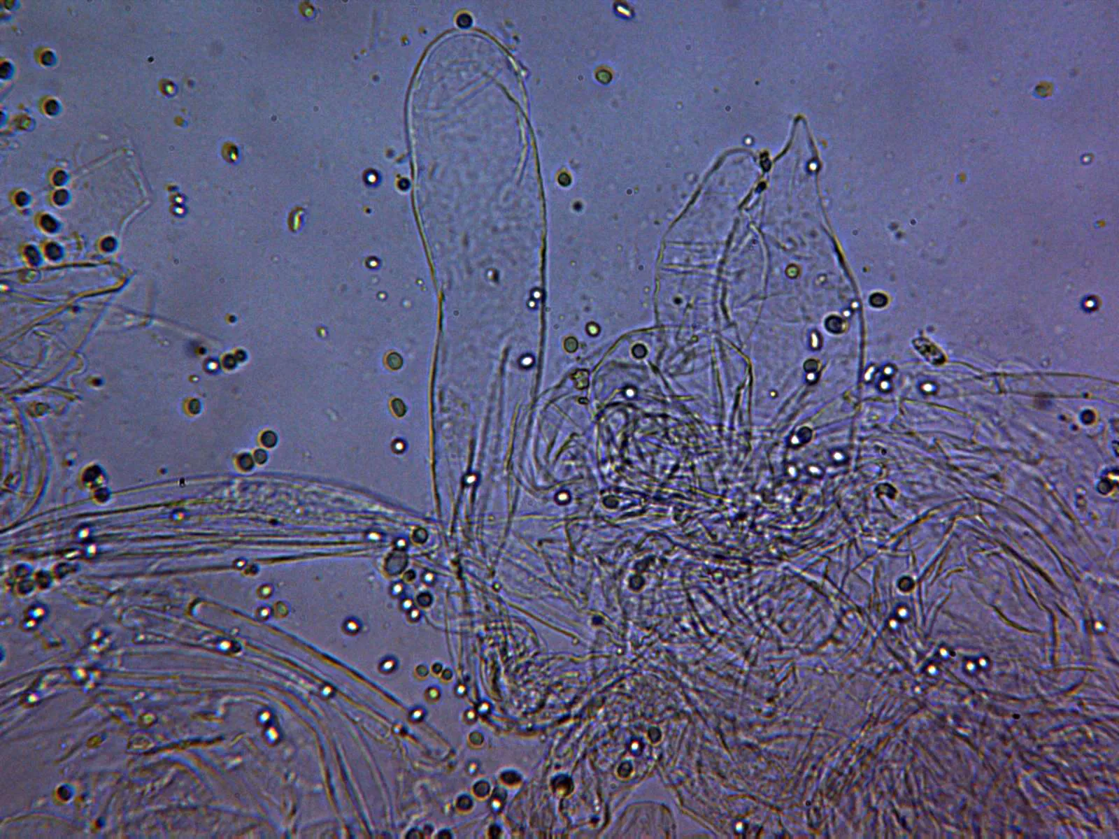 Microscopía de Mycena pearsoniana - 10 - Suprapellis agua x 400